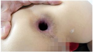 男の娘 ニューハーフ ケツマンコ アナル